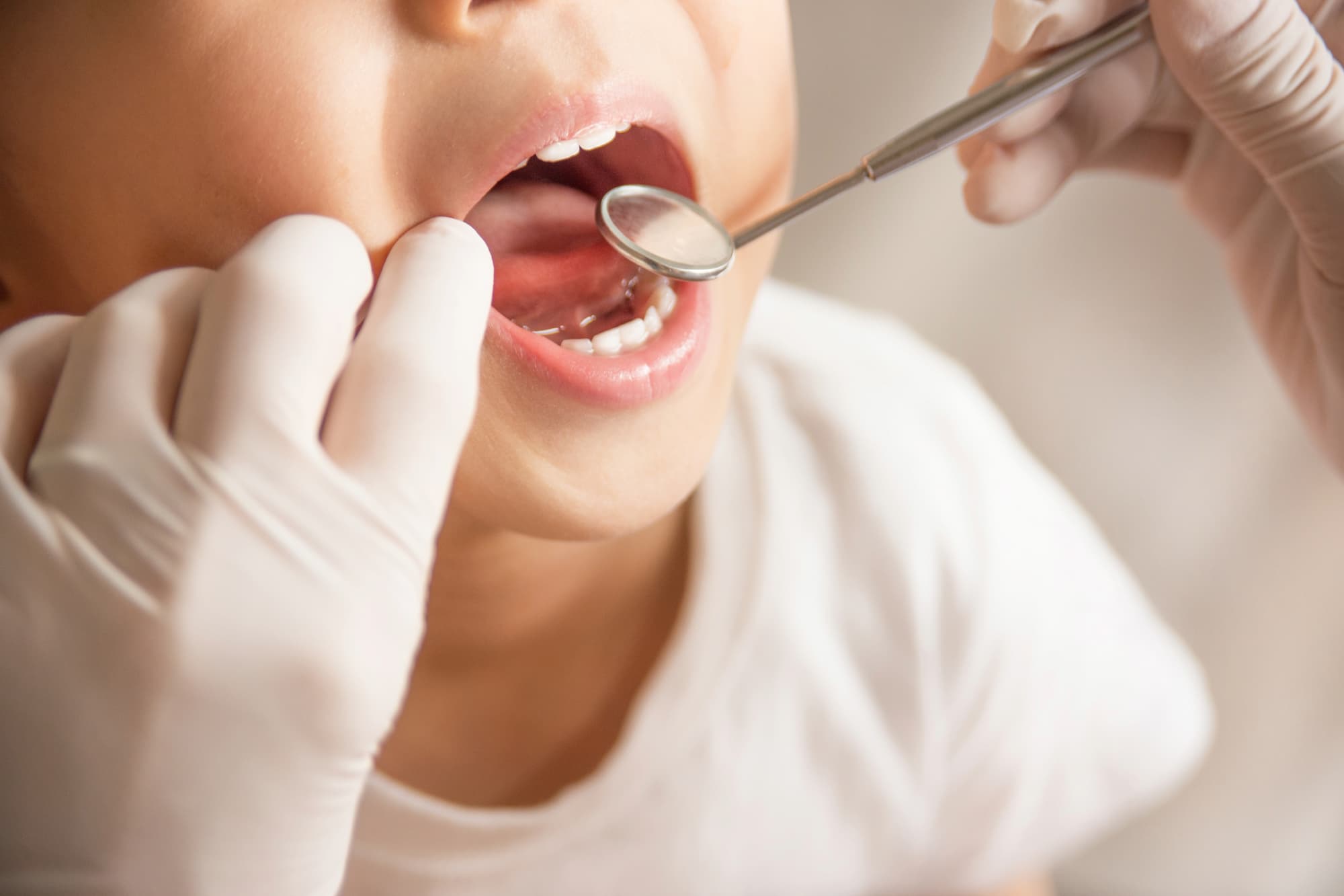 Dentalhygiene